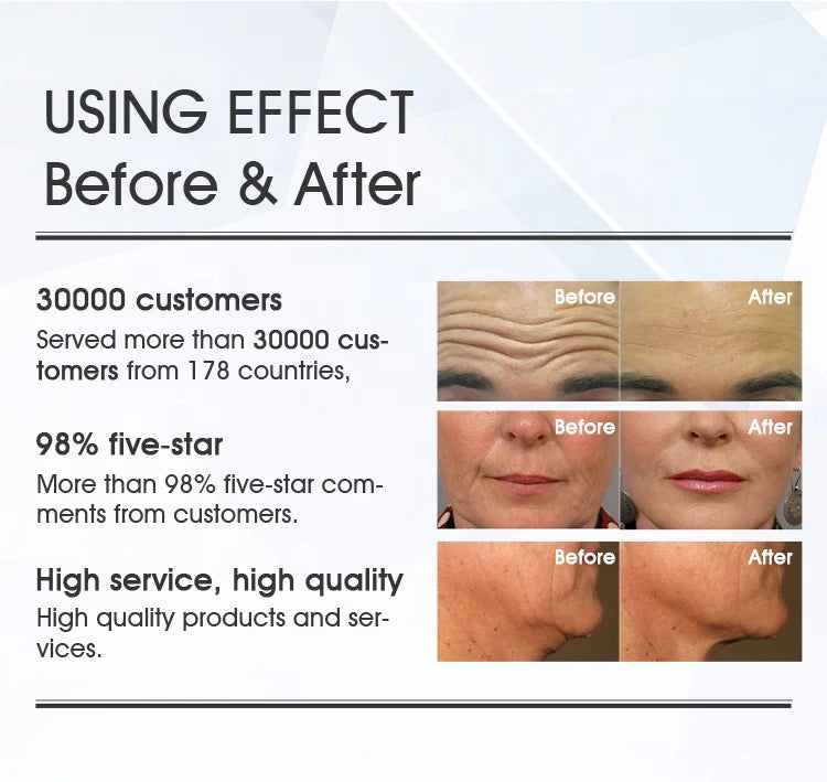 2025 Most Advanced Face Lifting Beauty Machine Analysis